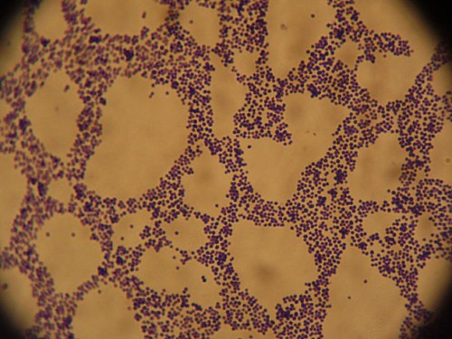 staphylococcus aureus gram stain. Anaerobic, gram-positive