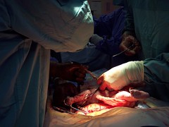 My Baby!  C-section