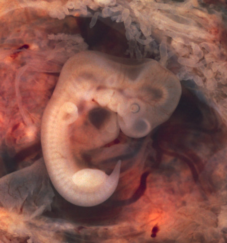 Embryo zevende week zwangerschap