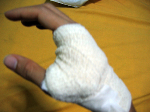 right hand injuried