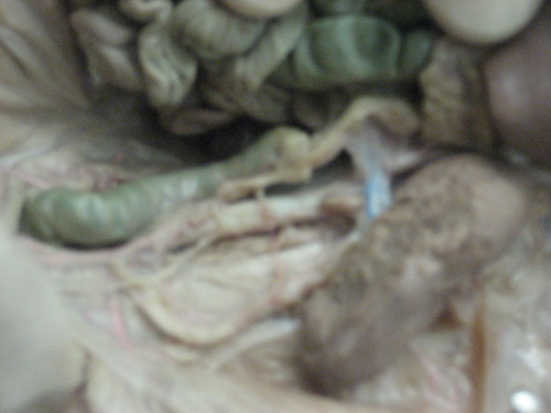 Fetal Pig Dissection. Warning: Fetal Pig Dissection