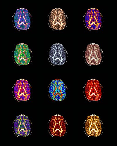 fMRI de cerebros