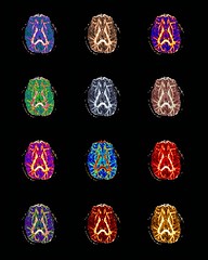 Brain collage