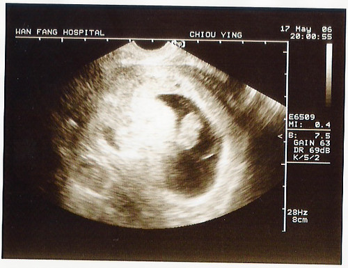 Baby 2個月