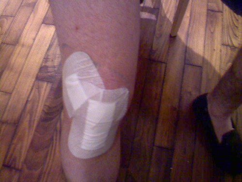 Knee with bandage
