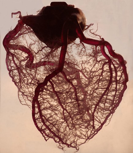 Фото Коронарные артерии сердца