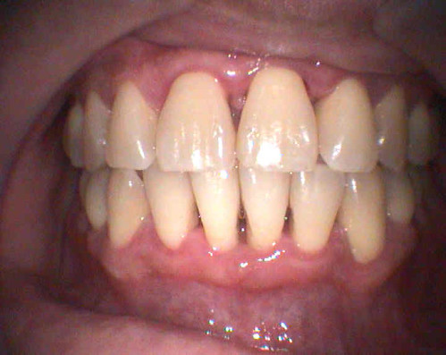 What+does+healthy+gums+look+like