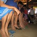 Landmine Survivors at play at the Care Villa on the Thai - Burma Border