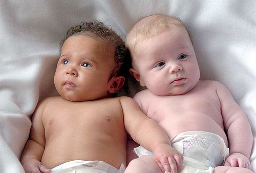 gemelos de distintas razas