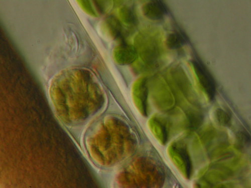 Algae-Cyanobact-Melosira HH-1000xHMC-195