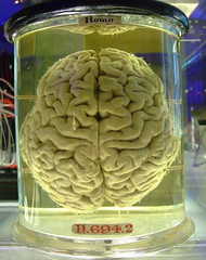Human brain - please add comment and fav this if you blog with it. by Gaetan Lee