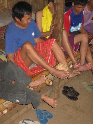 Landmine Survivors at play at the Care Villa on the Thai - Burma Border