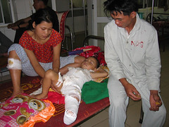 2 Year old Injured by Bomb IN Vietnam