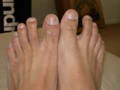 toenails still in place