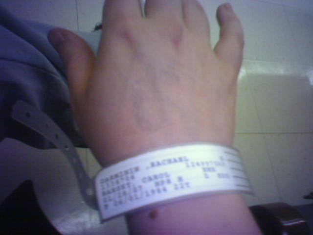 hospital bracelet