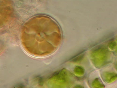 Algae-Diatoms HH-1000xHMC-169