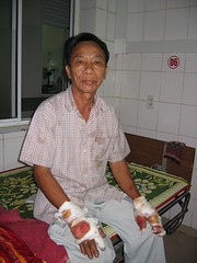 Man Injured by Bomb in Vietnam