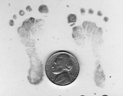 Micropreemie footprints