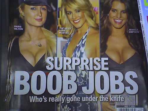 Heidi Montag, Jessica Simpson and Paris Hilton allegedly after plastic surgery for breast enhancement