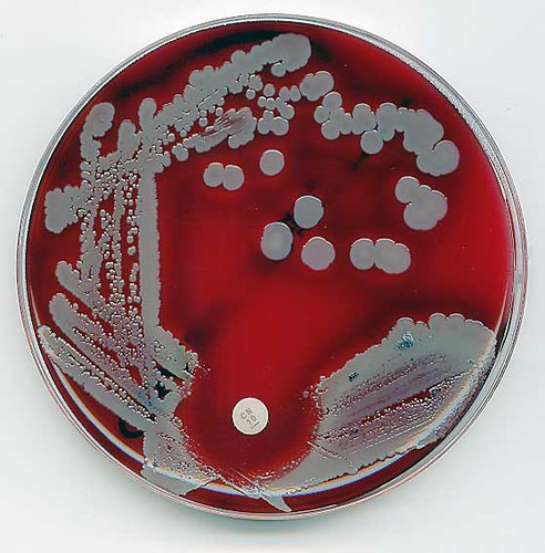 Staphylococcus aureus. 