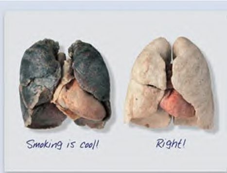 before and after smoking lungs. Bad lung (due to smoking) vs