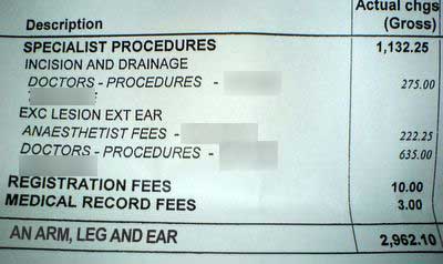 Ear surgery - hospital bill