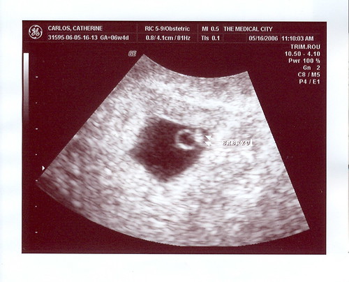ultrasounds at 6 weeks. 6 weeks and 4days as of May 6,