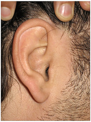 Seth's ear accupuncture chart