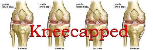 kneecapped
