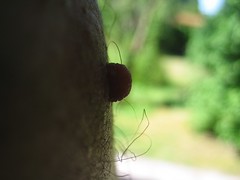 Male nipple on flickr