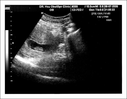 first ultrasonic scan.jpg