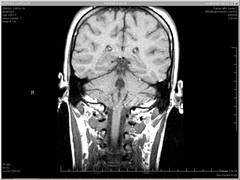 Carolyn - medical - MRI - 20060508 - series 7 ...