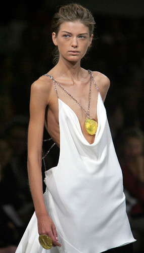 anorexic models. who is this model?