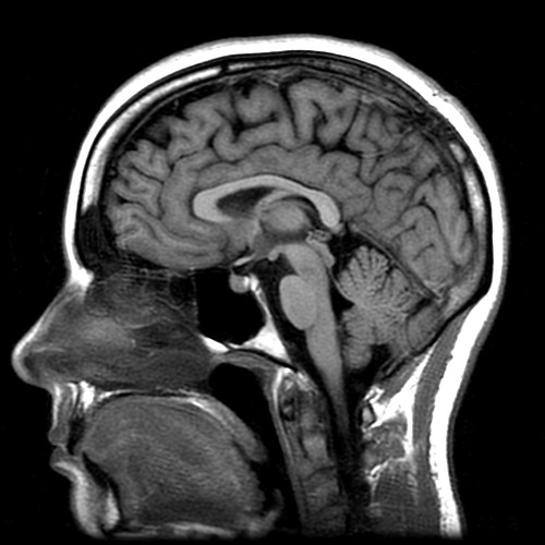 mri brain scan. MRI brain scan.
