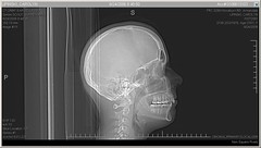 Carolyn - medical - CT scan - 20060824 - serie...