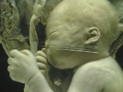image of a fetus.  what is its brain development?