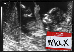 Ultrasound image with 'Hello my name is Max' sticker
