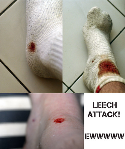 Leech Attack Bites