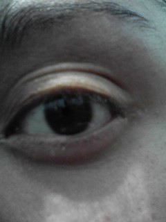 My Tired Eye