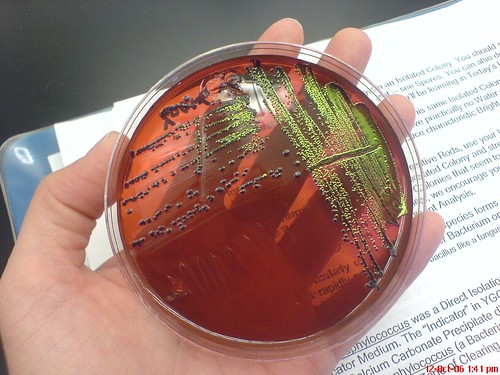'Metallic green E. coli on EMB plate'