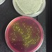 2016. MRSA growing in the lab. Atlanta, GA. Photo Credit: Cassandra Quave • <a style="font-size:0.8em;" href="http://www.flickr.com/photos/62152544@N00/43674597092/" target="_blank">View on Flickr</a>